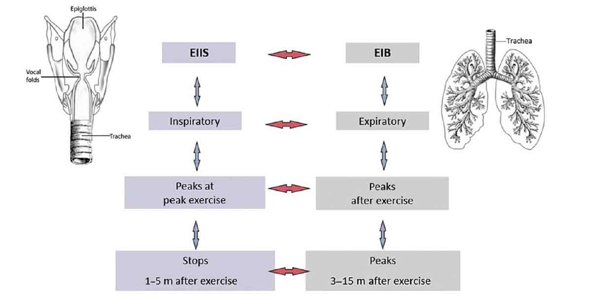 Exercise-induced inspiratory symptoms versus Exercise-induced bronchiorestriction