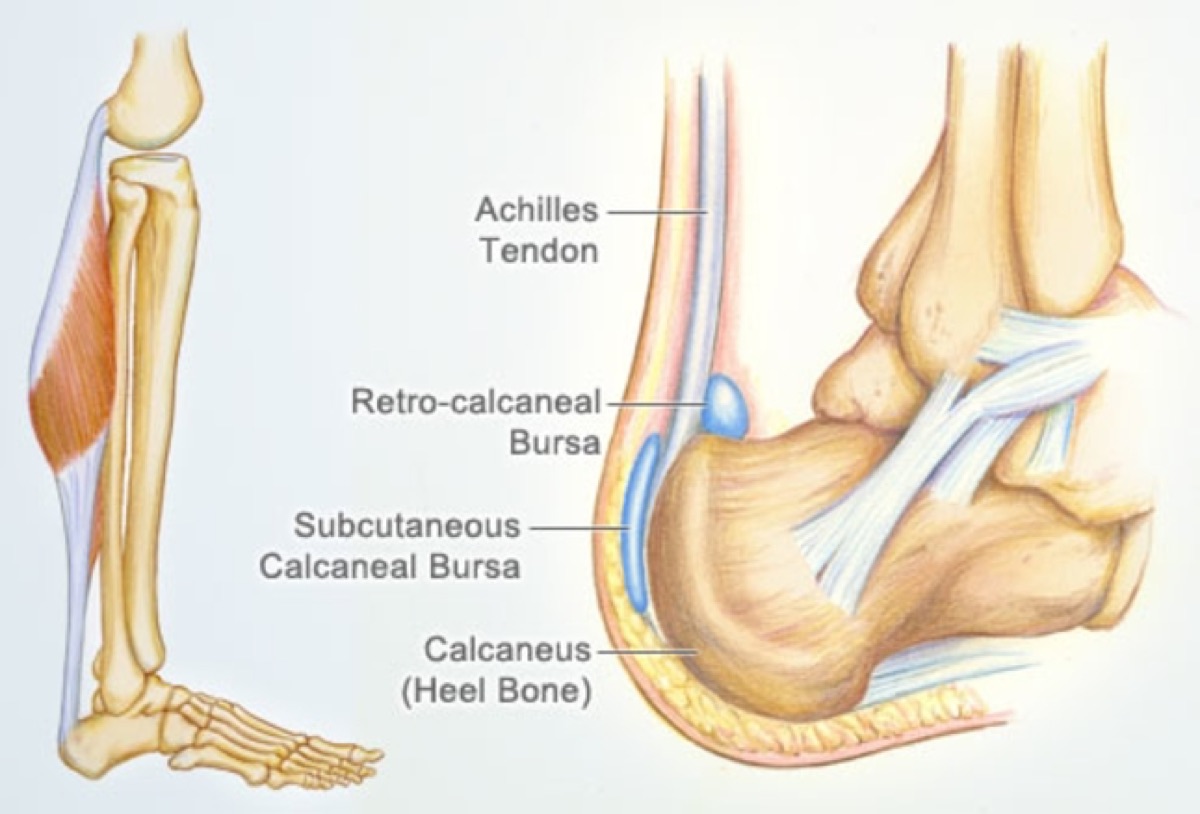 best running shoes for heel bursitis