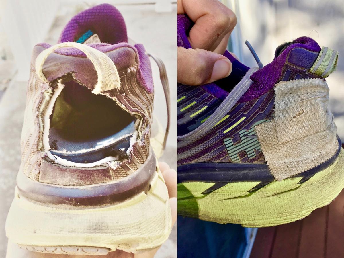 best athletic shoes for haglund's deformity