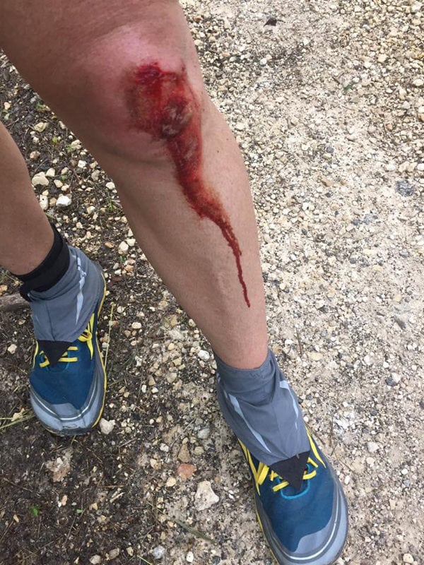 Knee Injury