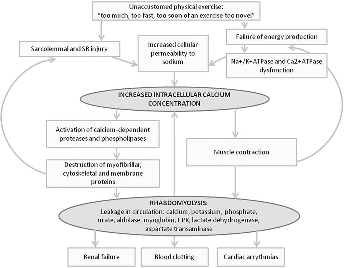 Rhabdomyolysis figure 3 large